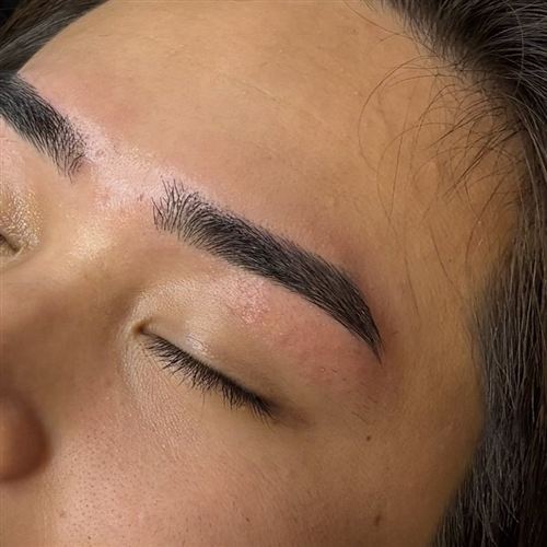 施術後の眉